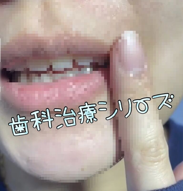 続・歯科治療レポート③