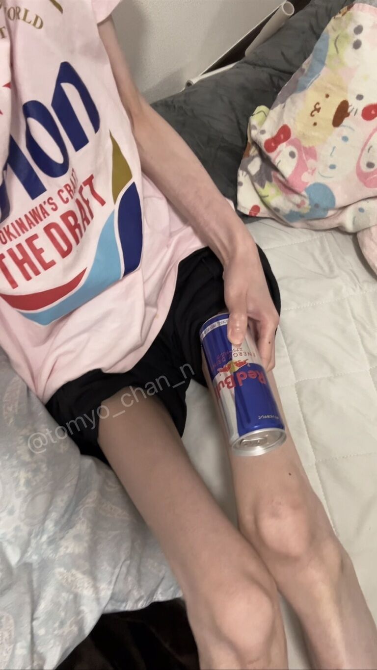 RedBullと手脚の比較+おまけ足裏